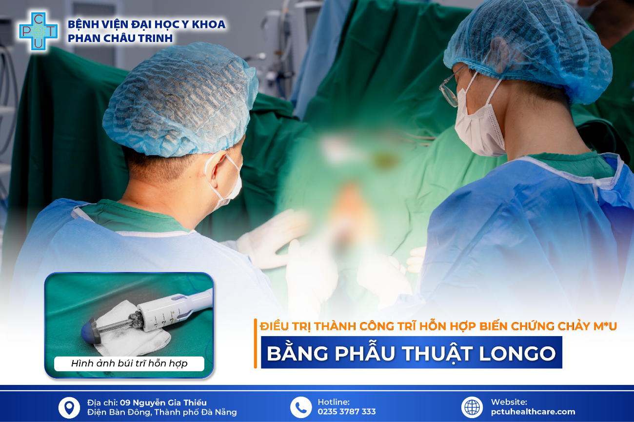 Điều trị thành công trĩ hỗn hợp biến chứng chảy máu bằng phẫu thuật Longo