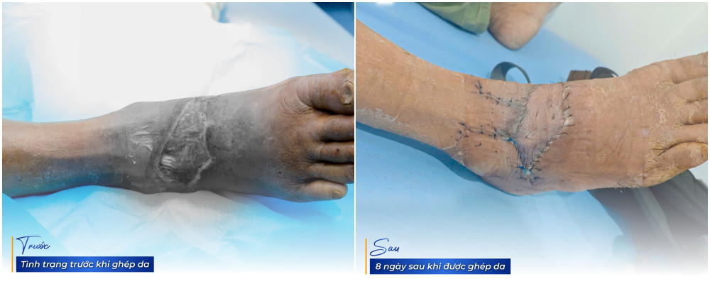 ghep_da_tao_vat_che_phu_3