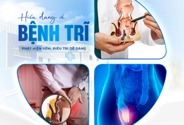 Hiểu đúng về Bệnh Trĩ - Phát hiện sớm, Điều trị dễ dàng