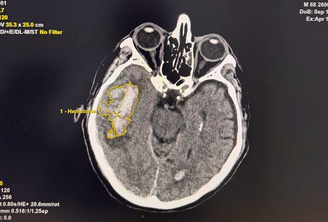 hinh_anh_MRI_nao