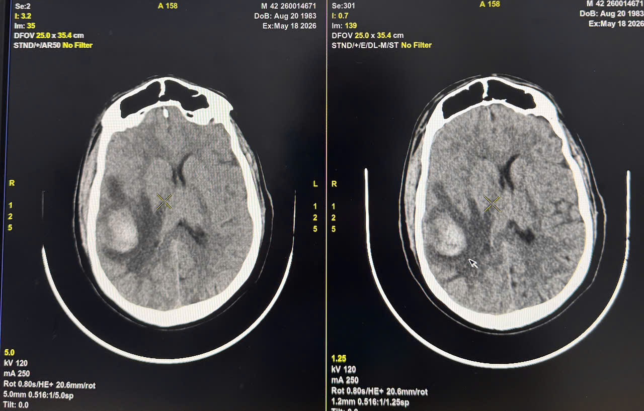 hinh_anh_chup_MRI_nao