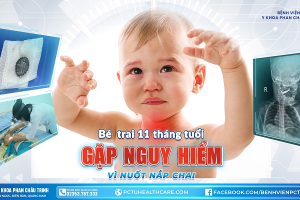 Cảnh báo tai nạn dị vật đường ăn: Bé trai 11 tháng tuổi nguy kịch vì nuốt nắp bia