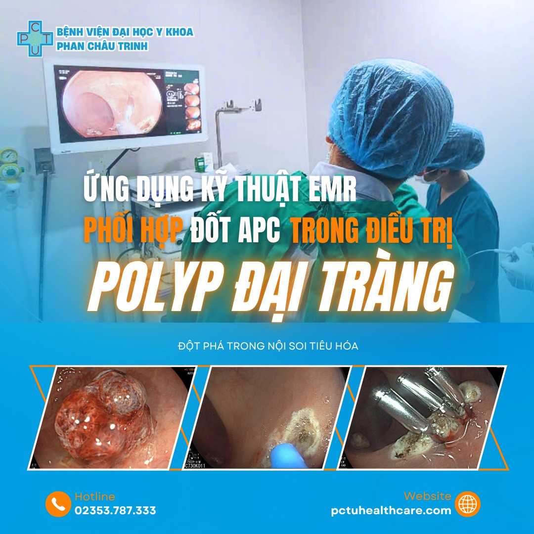 noi_soi_tieu_hoa_ung_dung_ky_thuat_EMR_dieu_tri_dai_trang