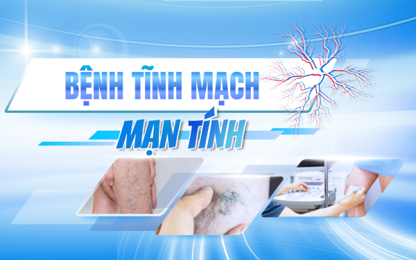 Bệnh Tĩnh Mạch Mạn Tính: Hiểu Đúng Để Điều Trị Hiệu Quả