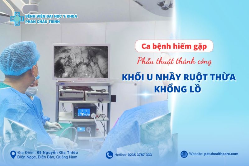 Phau_thuat_thanh_cong_khoi_u_nhay_ruot_thua_khong_lo