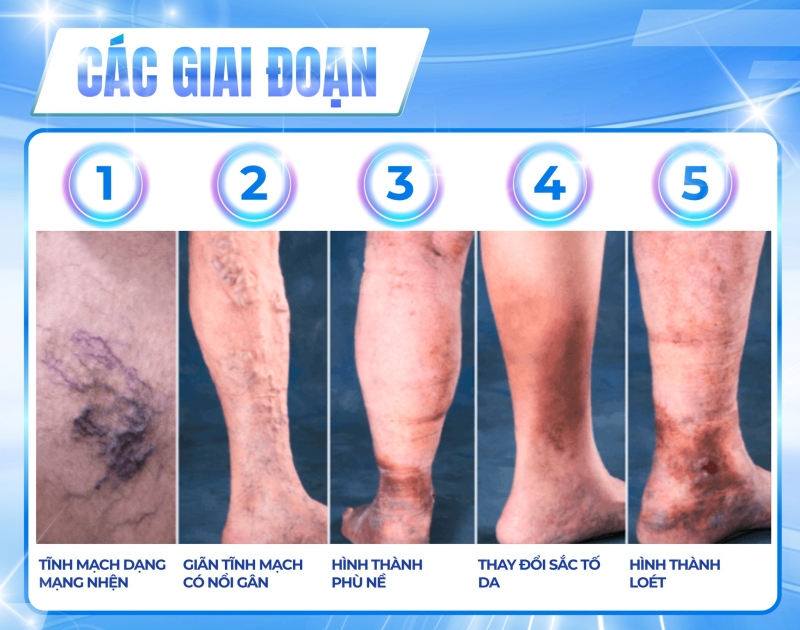 cac_giai_doan_tinh_mach_man_tinh
