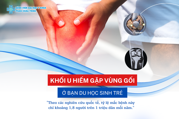 Khối U Hiếm Gặp Vùng Gối ở bạn du học sinh trẻ
