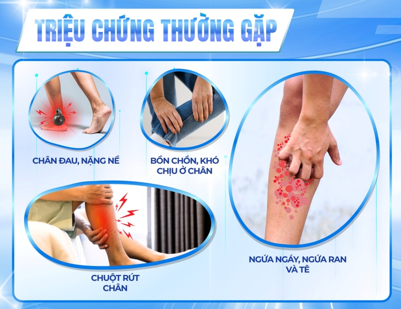 trieu_chung_gian_tinh_mach_man_tinh