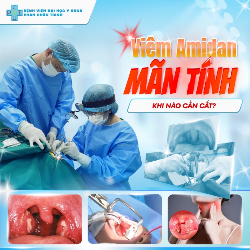 viem_amidan_man_tinh_tre_em