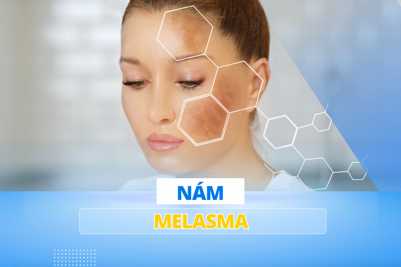 Nam_da_1