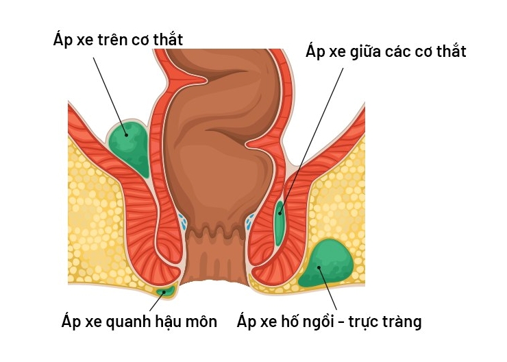 ap_xe_hau_mon