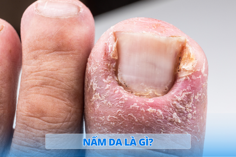 nam_da_la_gi