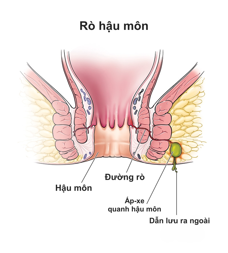 ro_ri_hau_mon