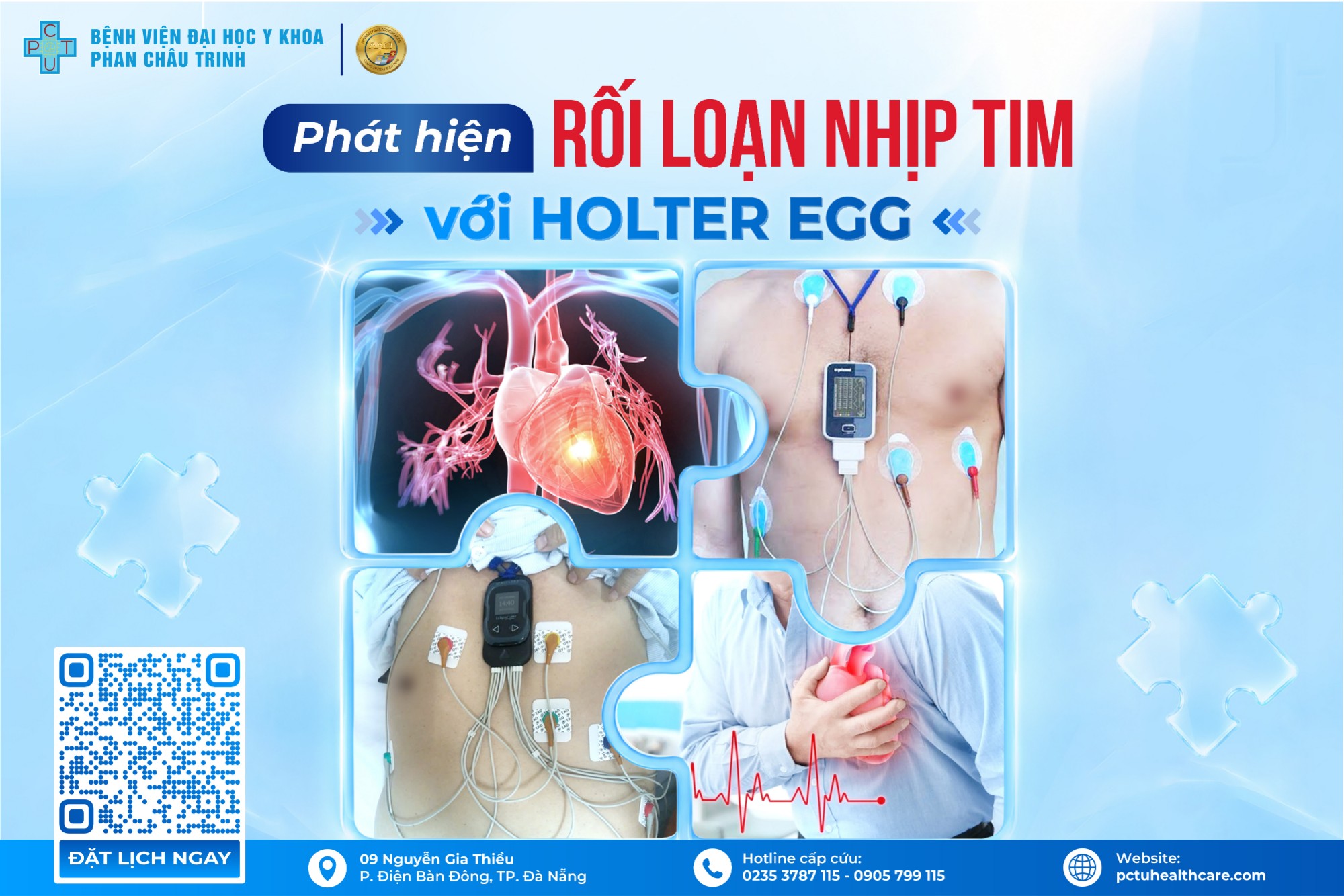 Phát hiện rối loạn nhịp tim với Holter ECG
