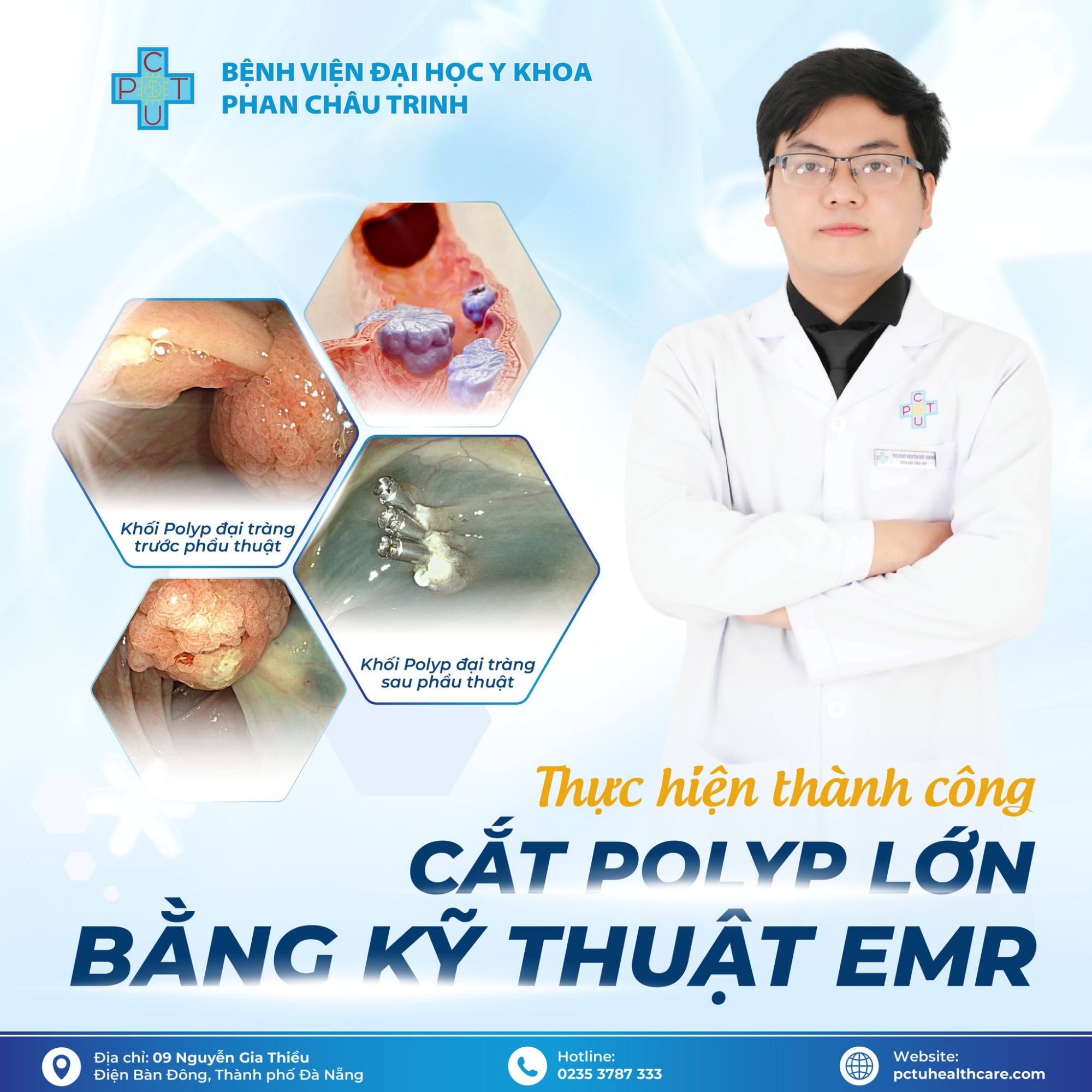 nguyen_duc_quang_cat_polyp_dai_trang