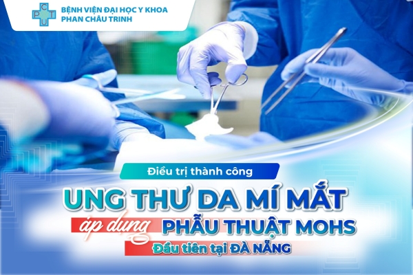 Áp dụng Phẫu thuật Mohs lần đầu tiện tại Đà Nẵng trong điều trị Ung thư da mí mắt: Chính xác & Thẩm mỹ tối đa