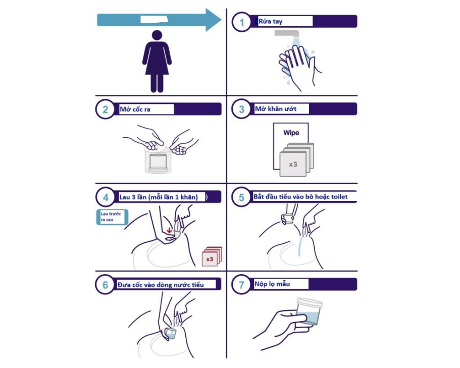 cac_buoc_lay_mau_benh_pham_nhiem_trung_tiet_nieu_thai_ky