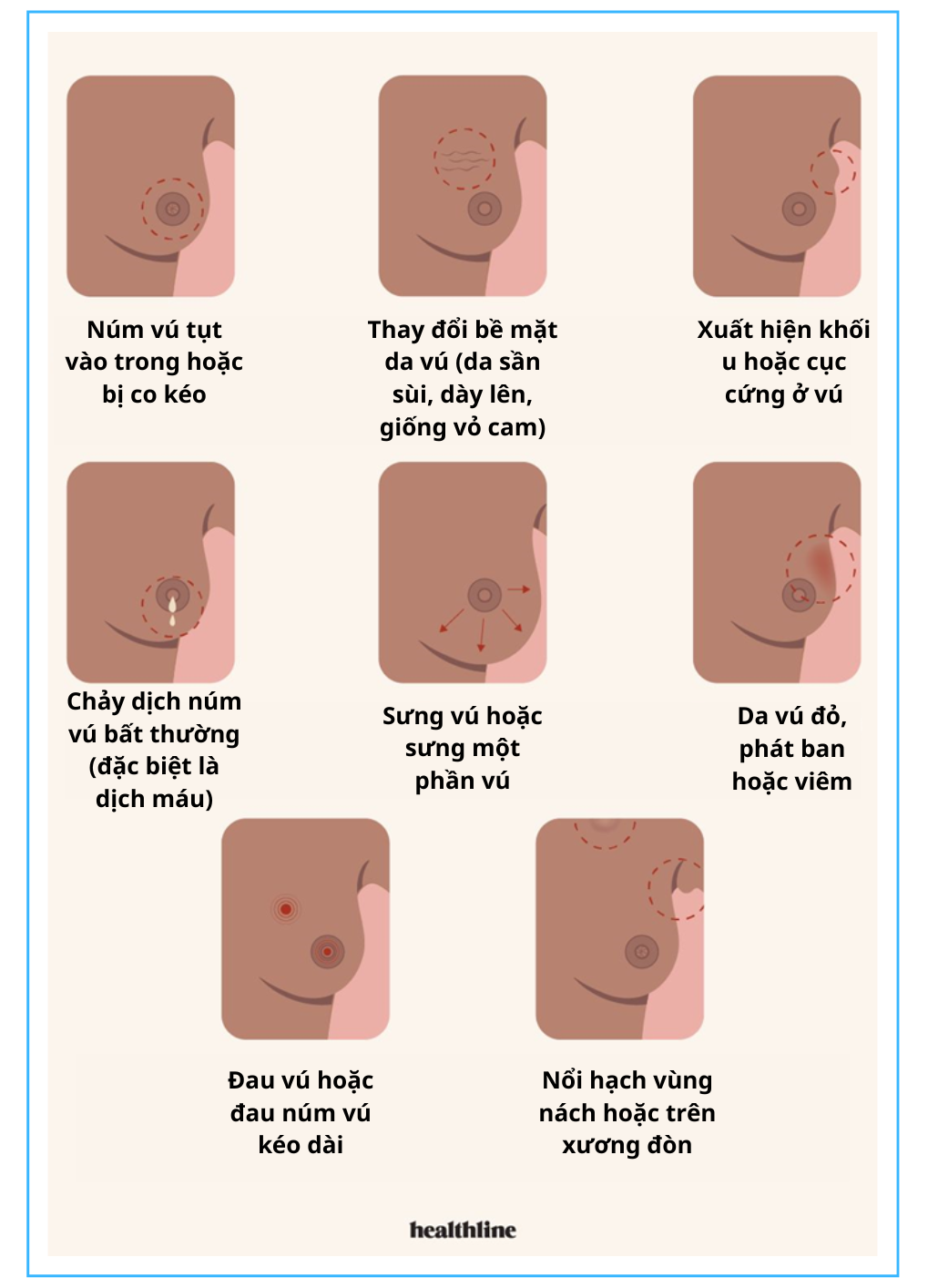 Hình 3: Mọt so dau hieu bat thuong 