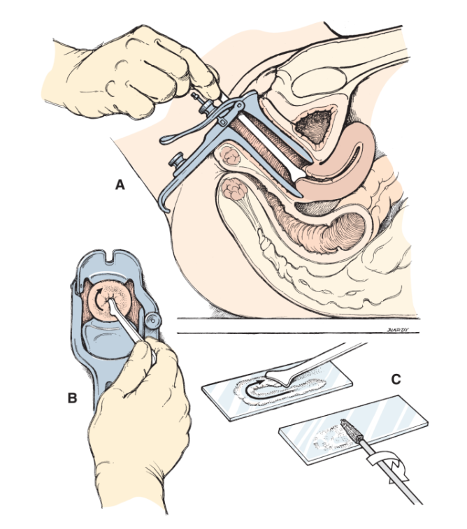 ky_thuat_lay_mau_benh_pham