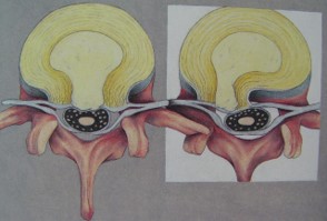 nguyen_nhan_thuong_gap