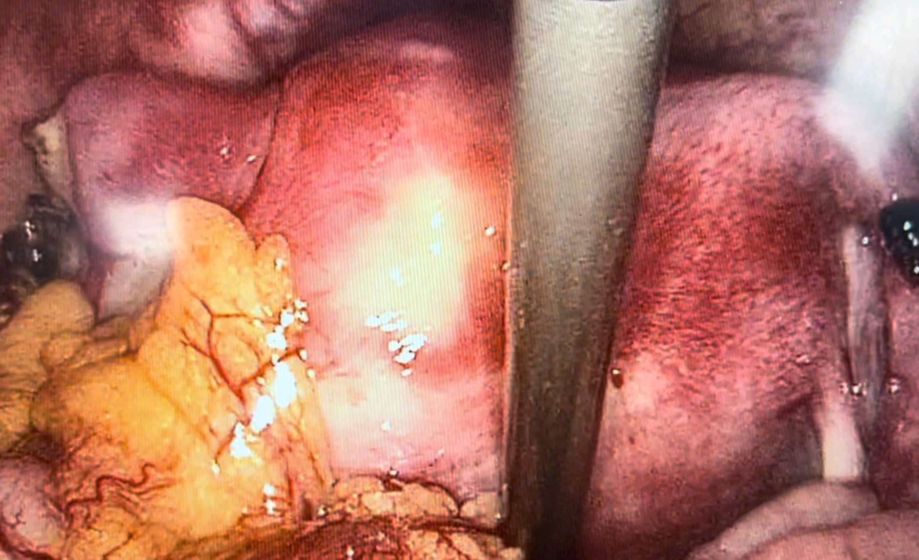 thai_ngoai_tu_cung_pctu_2